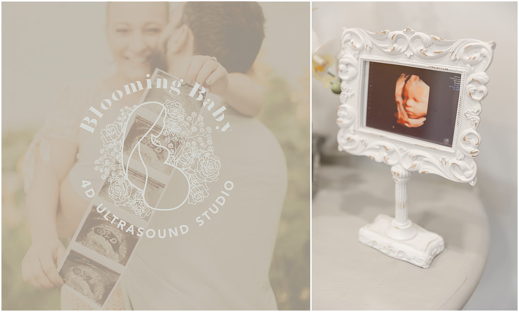 Framed 4D ultrasound photo of baby displayed as a keepsake from Blooming Baby in Wake Forest, NC