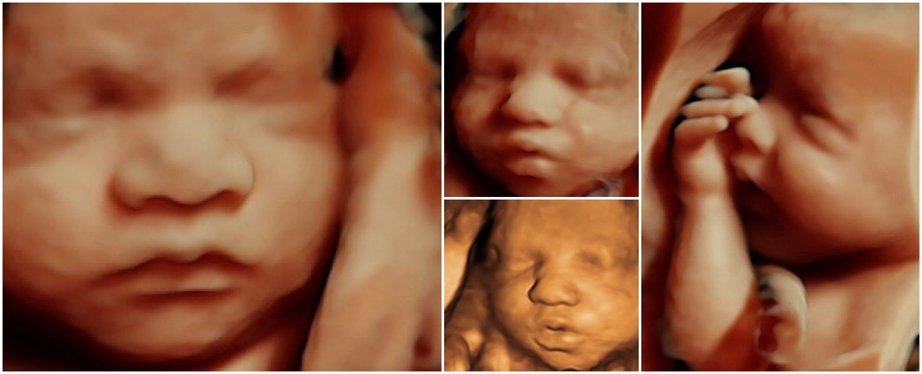 Collage of 3D and 4D ultrasound images showing baby’s face and features at Blooming Baby in Wake Forest, NC